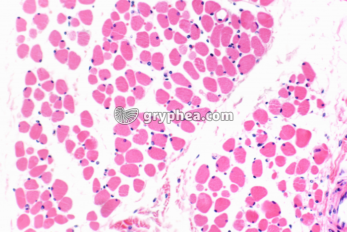 Fibres musculaires striées CT x100 - gryphea.com